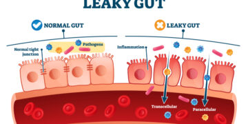 What Is Leaky Gut And How You Can Help Fix It!
